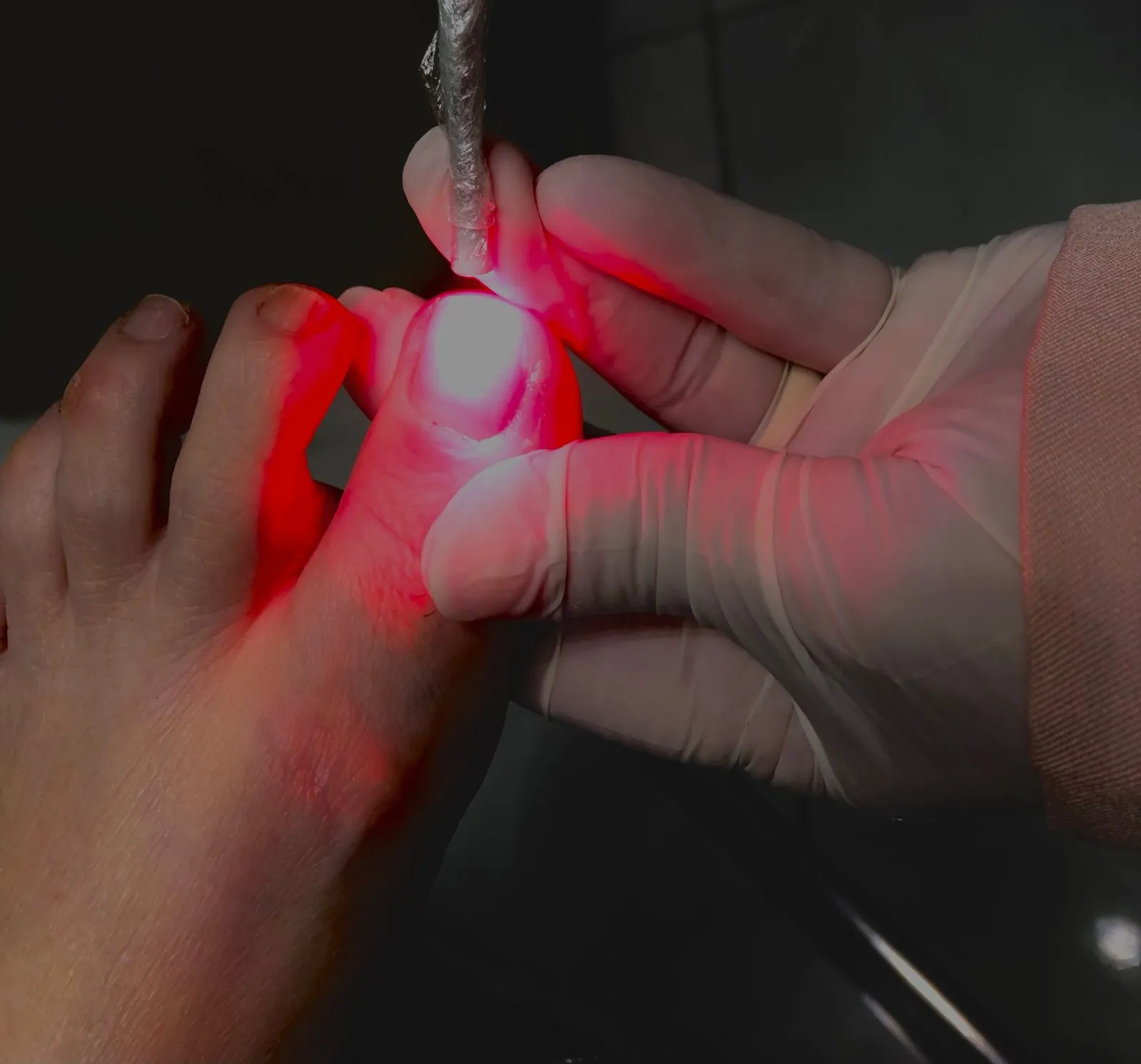 Tratamento de laser e terapia fotodinâmica na Podologia ABC